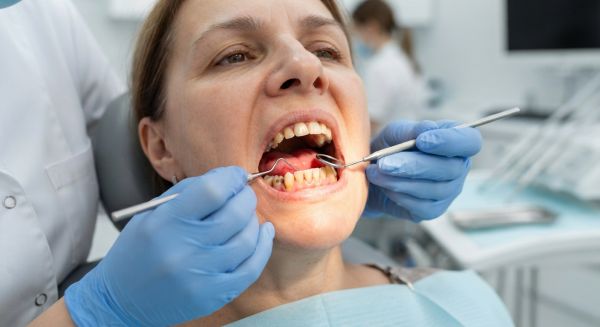 Comment le diabète affecte-t-il la santé dentaire ?